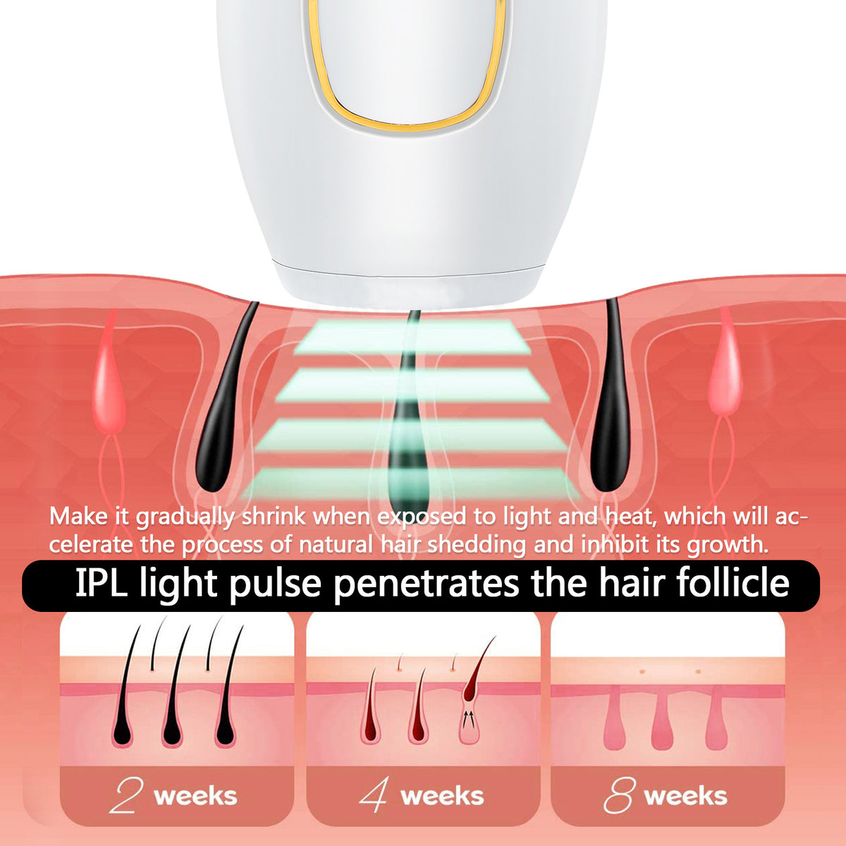 جهاز إزالة الشعر المنزلي IPL صغير الحجم
