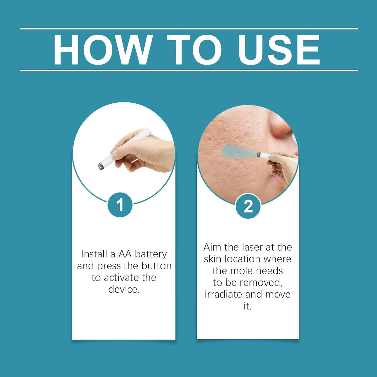 Xorita Mole and Wart Removal Pen