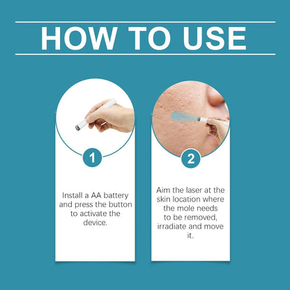 Xorita Mole and Wart Removal Pen